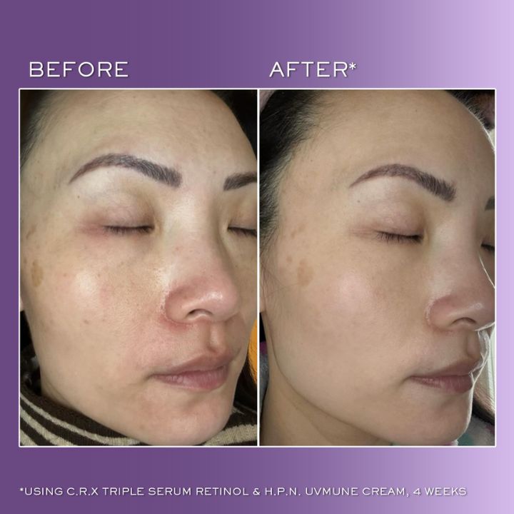 Lancome Anti-Ageing Duo Set