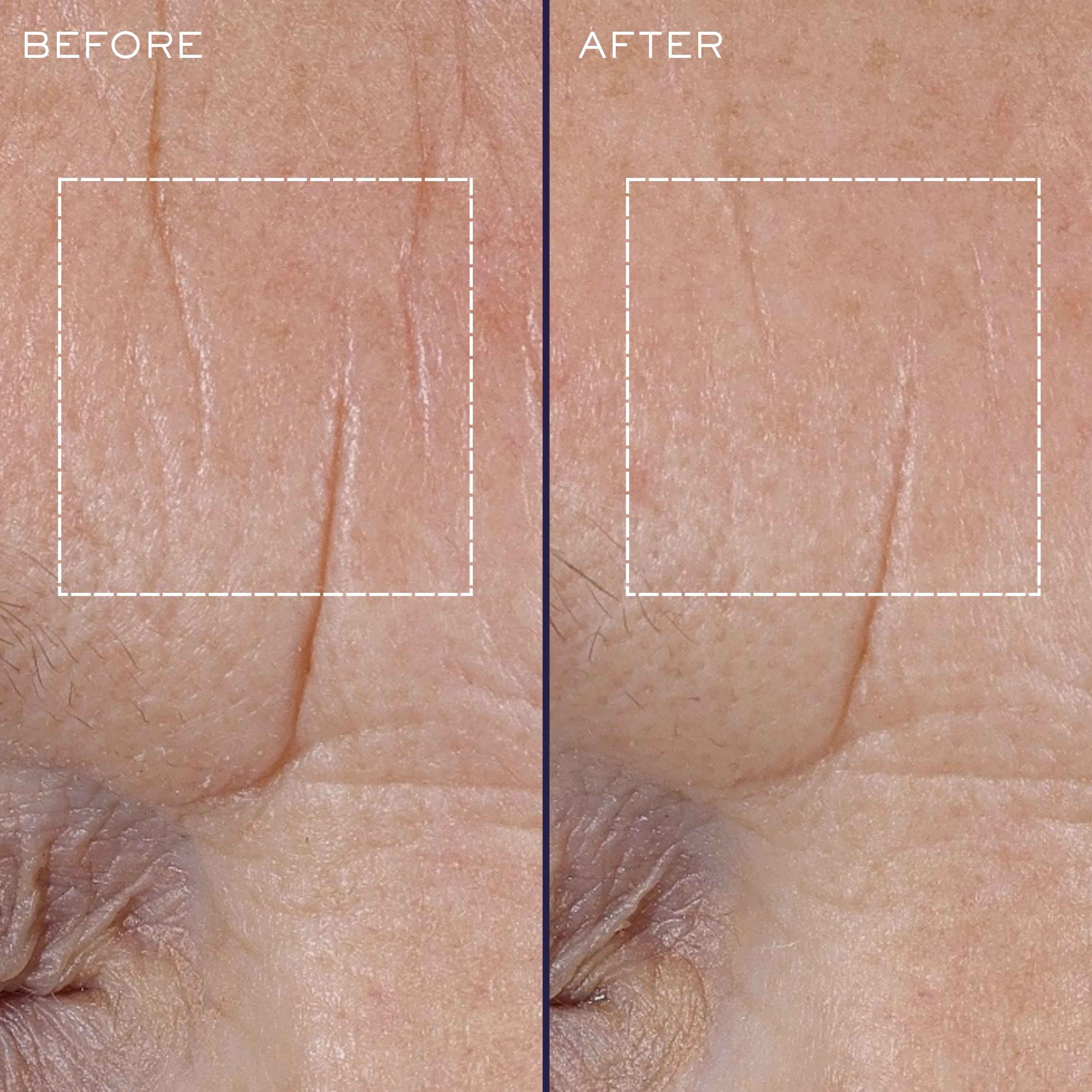 Renergie High Performance Starter Bundle