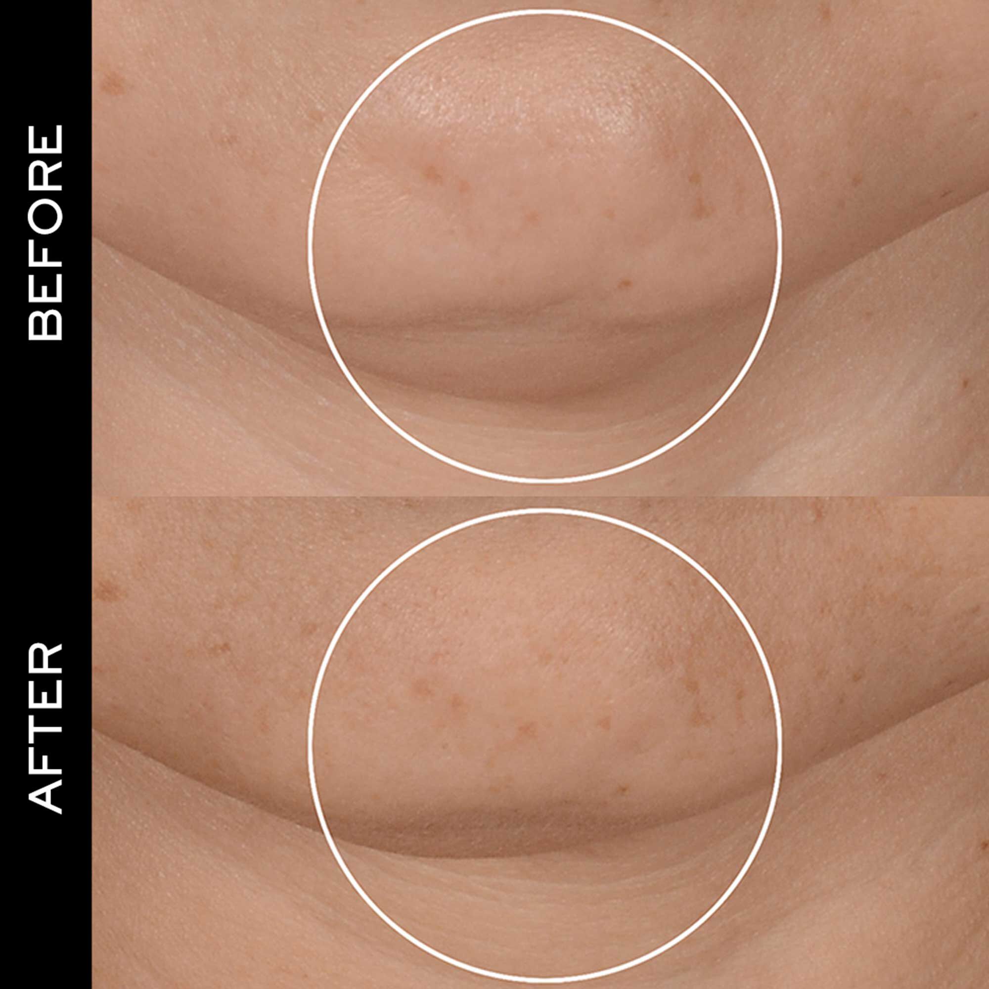 RENERGIE H.P.N. 300-PEPTIDE CREAM